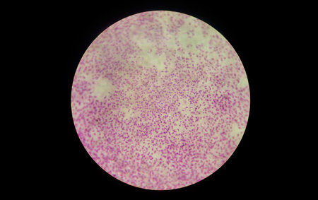 microscope lens, viewing Trypanosoma cruzi parasitic protozoan, causer of Chagas disease