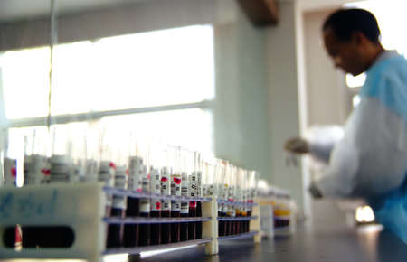 blood test tube on lab