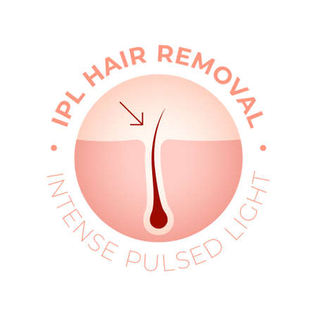 IPL Laser hair removal vector illustration conceptのイラスト素材