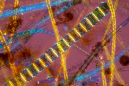 Colorful, polarizing micrograph of Ulothrix, a freshwater green algae, taken at 200x.