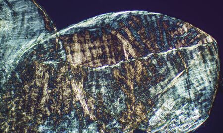 Abstract, polarizing micrograph showing   tissue from an earthworm. Taken at 100x.の写真素材