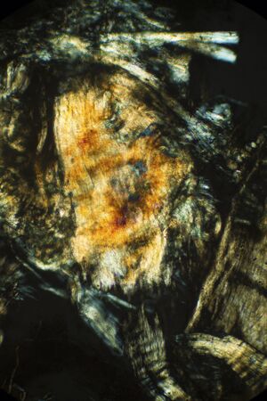 Abstract, polarizing micrograph showing muscle tissue from an earthworm. Taken at 100x.
