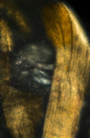 Abstract, polarizing micrograph of muscle fibers from an earthworm, taken at 200x.の写真素材