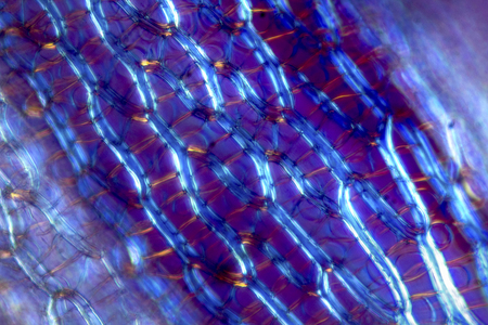 Cells from a leaf of the peat moss, Sphagnum, showing ring like thickenings of the cell walls, and...
