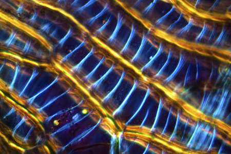 Abstract micrograph of  cell wall thickenings in linear leaf cells of the submerged peat moss,...