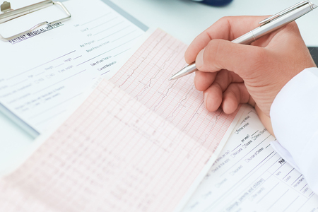 Professional male doctor is explaining the result selectrocardiogram to patients. Medical and healtcare concept.の写真素材