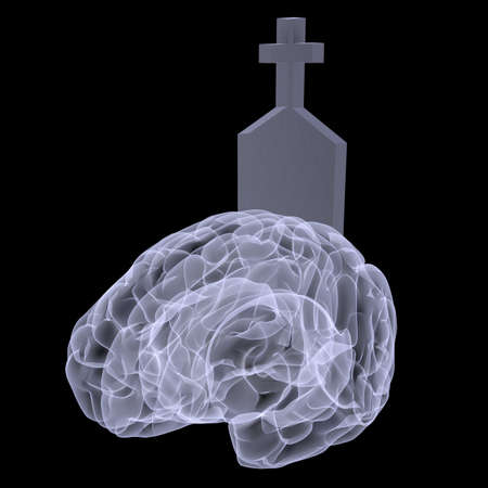 Brain Dead X-ray- an x-ray of a brain with a gravestone marker sticking out.の写真素材