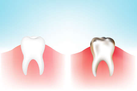 Tooths With Gradient Mesh, Vector Illustration