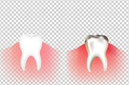 Tooths With Gradient Mesh, Vector Illustrationのイラスト素材