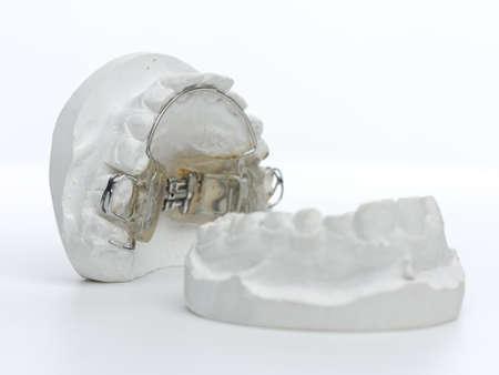 Gray Dental Prosthesis Teeth Mold, Clay Human Gums Model tooth braceの写真素材