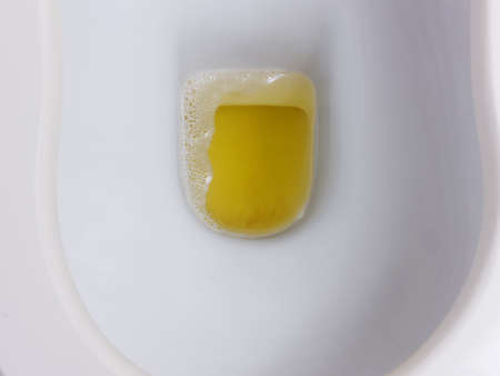 Closeup urine or pee in the toilet bowlの写真素材