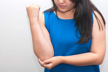 Young woman with elbow painの写真素材