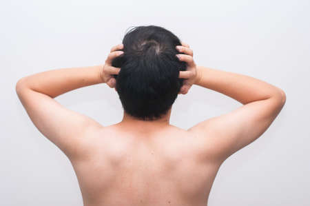 Young man having a headacheの写真素材