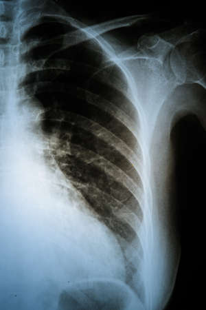 View of x-ray human film