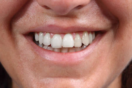 smile