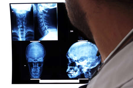 the doctor looks at MRIの写真素材