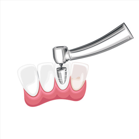 Tooth Cleaning Illustration, Healthy Teeth, Dentist Vector Illustration, Oral Careのイラスト素材