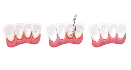 Tooth Cleaning Illustration, Healthy Teeth, Dentist Vector Illustration, Oral Careのイラスト素材