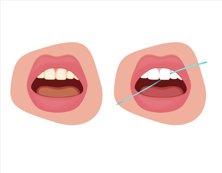 Tooth Needle Illustration, Healthy Teeth, Dentist Vector Illustration, Oral Careのイラスト素材