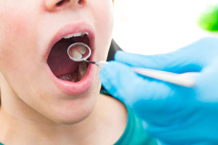 dentist looking at the mouth with tools and mirrorの写真素材