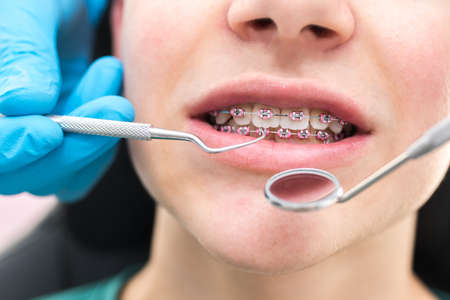 dentist looking at the mouth with tools and mirrorの写真素材