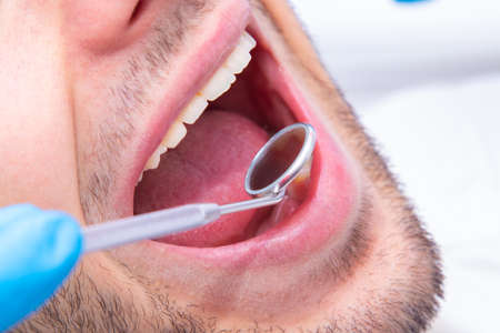 open mouth with dentist's mirror