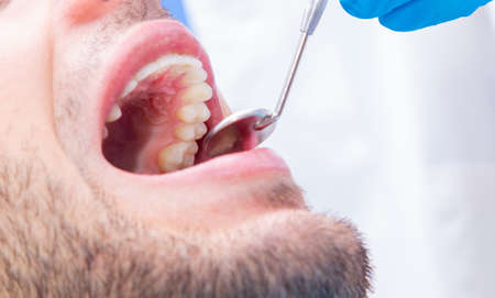 dentist with tools working on the patient's mouthの写真素材
