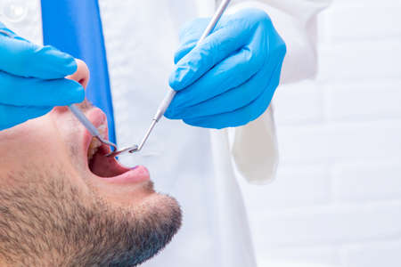 dentist with tools working on the patient's mouthの写真素材
