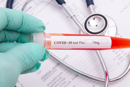 hand with collection tube for coronavirus testの写真素材