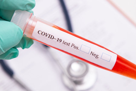 coronavirus infection test tubes in hospital