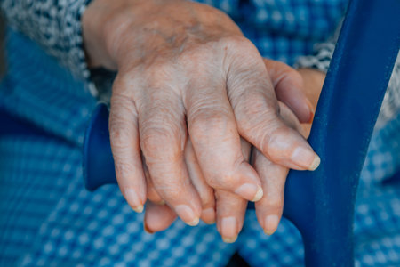 hands of a 90s woman with osteoarthritisの写真素材