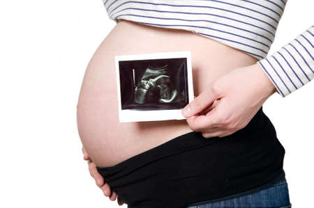 Pregnant woman hands holding ultrasound photoの写真素材