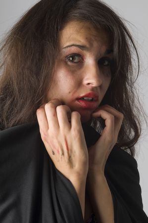 young woman in fear after a probabily fight against somebodyの写真素材