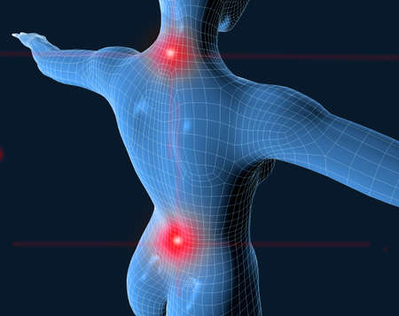 3d mesh blue human with pain in the neck and kidneyの写真素材
