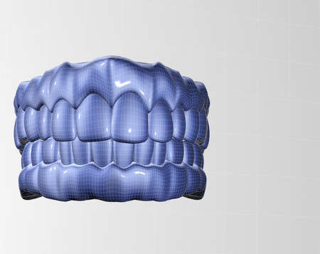 3d image of mesh denture isolared in whiteの写真素材