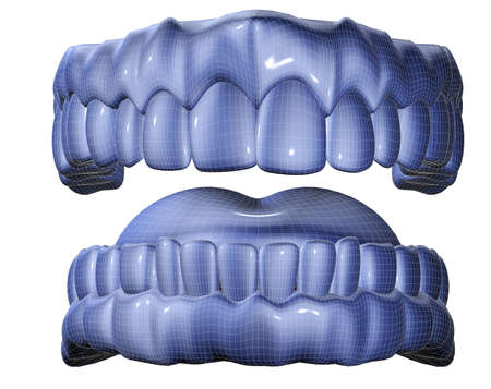 3d image of mesh denture isolared in whiteの写真素材