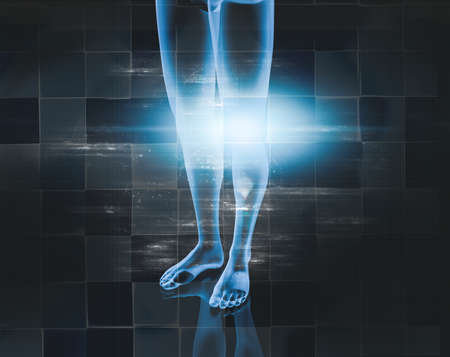 Medical imaging and medical treatments. Concept of analgesics and muscular pain and inflammation of the knee and meniscus.3d illustration.の写真素材