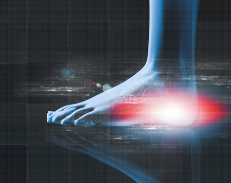 Medical imaging and medical treatments. Concept of analgesics and muscular pain and inflammation of feet and heel.3d illustration.の写真素材