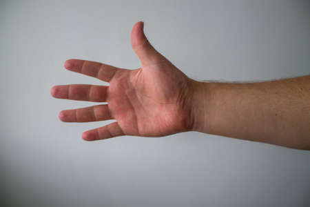 Palm of a man's right hand.