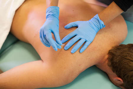 Doctor sticks needle into man's body on the acupunctureの写真素材