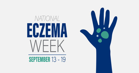 National Eczema Week. September 13 - 19, 2023 vector awareness campaign banner.&#xD;&#xA;のイラスト素材