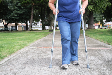 Unrecognizable person walking towards the camera with the help of crutches. Concepts: reduced mobility, recovery and physical rehabilitation after an injuryの写真素材