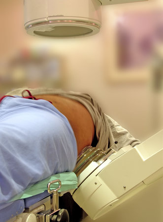 A real lithotripter (kidney stone blaster). A doctor uses fluoroscopy (above the patient) to view the progress. The stones are broken up by shockwaves from below the patient.の写真素材