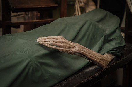 The dead body. Focus on hand decay.の写真素材