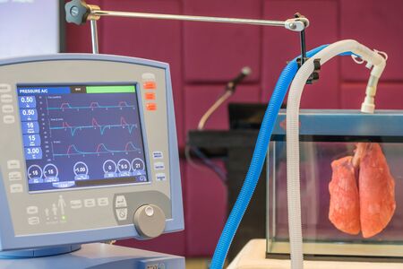 The waves of blood pressure EKG in monitor for ICU room.の写真素材