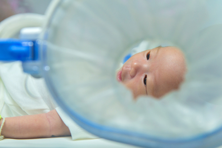 newborn baby girl get the light therapy inside incubator at hospital.の写真素材