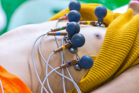 ECG or EKG of man with electrodes for electrocardiogram records on bed in hospital.の写真素材