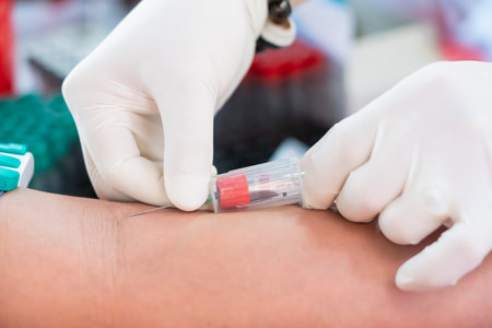 Nurse collecting a blood from patient in hospital.の写真素材