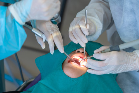 doctor cleaning the teeth patient with ultrasonic tool.の写真素材