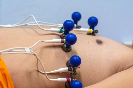 ECG or EKG of man with electrodes for electrocardiogram records on bed in hospital.